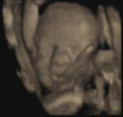 foto k příspěvku  od JR