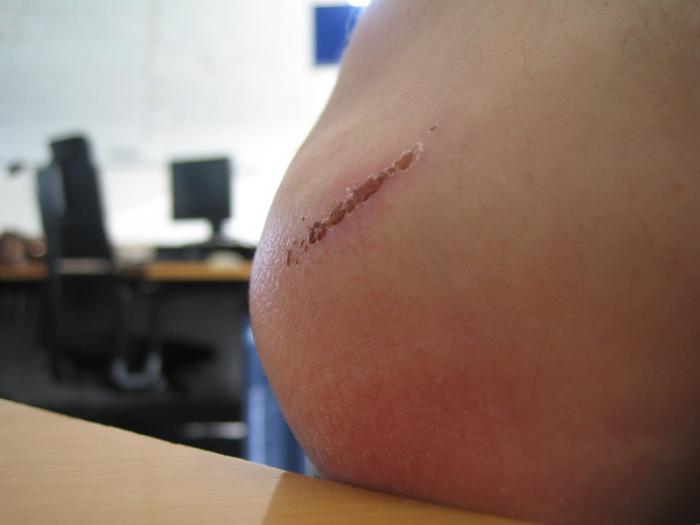 foto k příspěvku  od Lucass