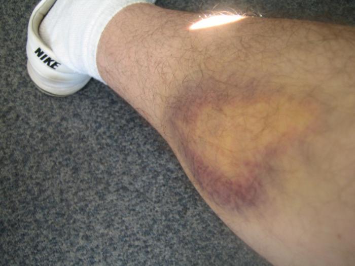 foto k příspěvku  od Lucass